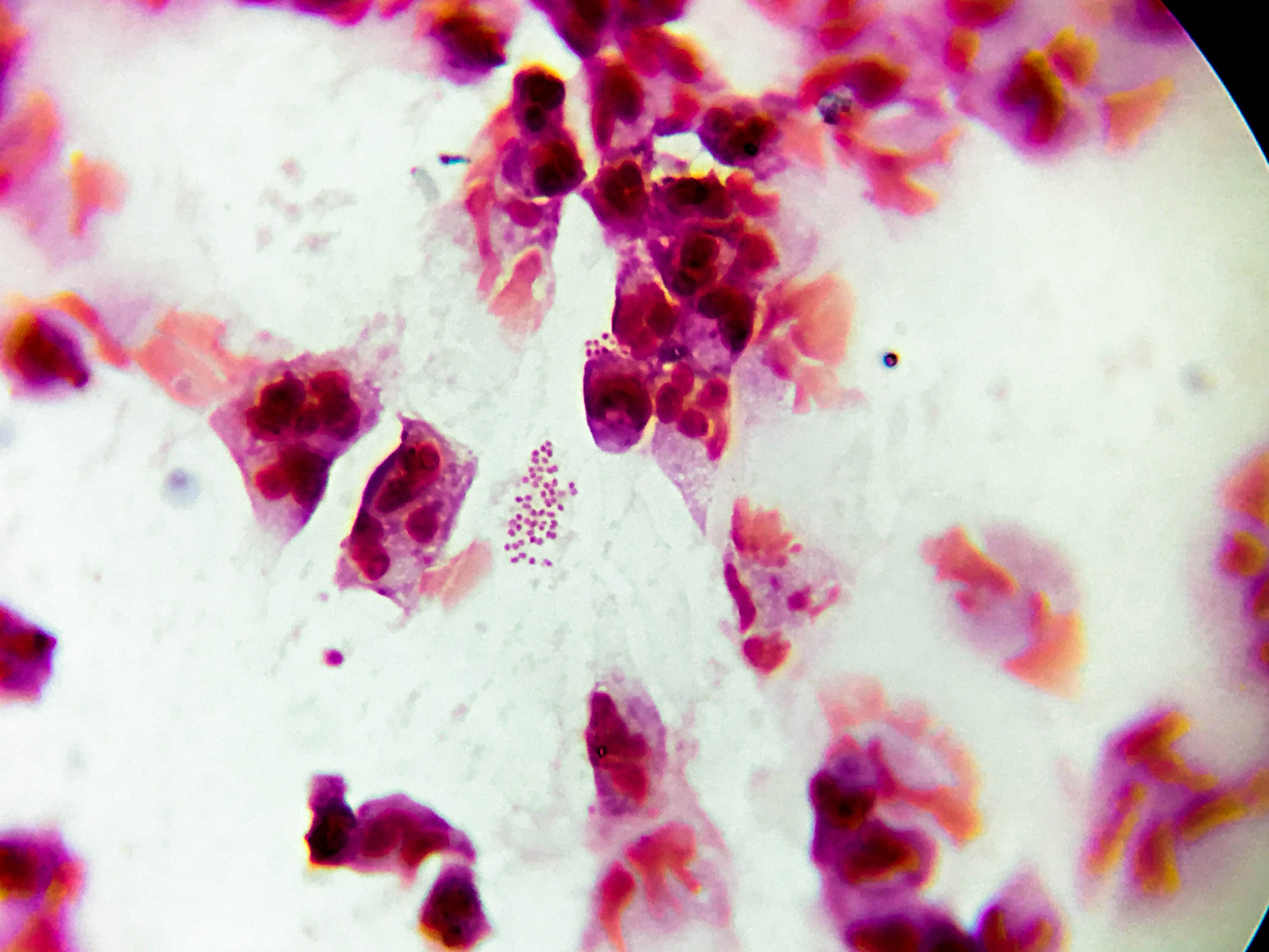 Гонококки хламидии. Chlamydia trachomatis под микроскопом. Хламидия под микроскопом.