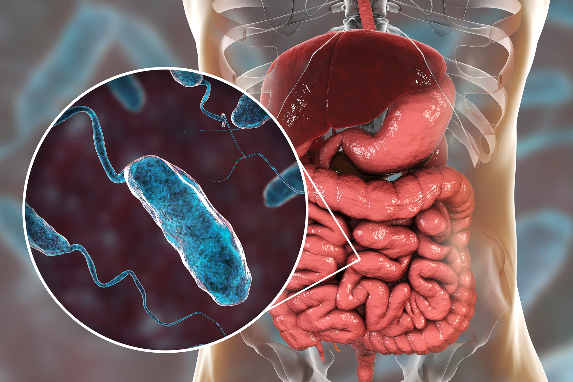 Gut microbiome confers variable resistance to cholera | Infection Update